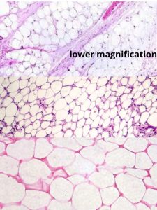 Image of adipose tissue.