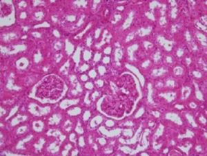 Kidney tissue image