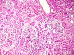 Kidney tissue image