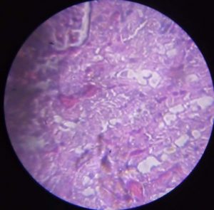 Image of a kidney cell.