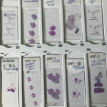 Picture of cell samples.