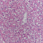 Liver cell