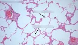 Lung tissue cell image