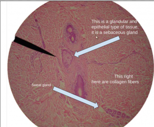 Microscopic skin image